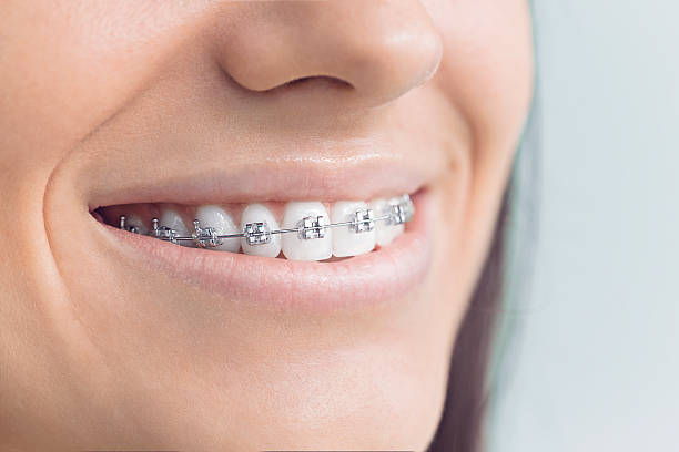 Professional Dental Services in Fort Bragg, CA